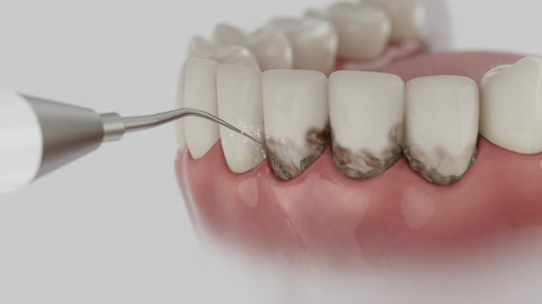 Trusted Teeth Cleaning And Checkup service in Palmer, AK - Dentist Open Now